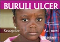 Buruli Ulcer Recognize Act now : A Guide for field health workers.