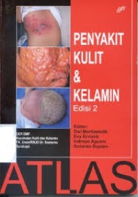 Penyakit kulit dan kelamin