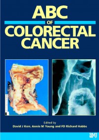 ABC  of Colorectal Cancer