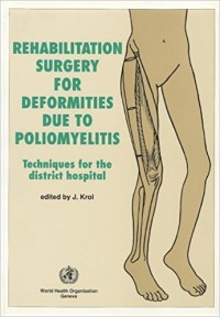 Rehabilitation Surgery For Deformities Due To Poliomyelitis : Techniques for the district hospital.
