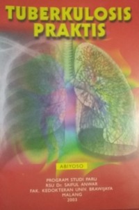 Tuberkulosis praktis